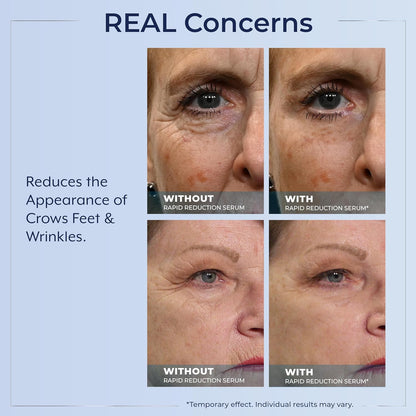 Plexaderm Rapid Reduction Serum – Instantly Reduces Under Eye Bags, Dark Circles, Crow’s Feet, Fine Lines & Wrinkles in Minutes – Temporary Tightening Face Serum for Smoother-Looking Skin