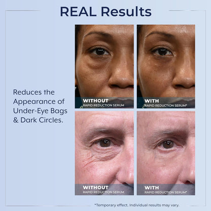 Plexaderm Rapid Reduction Serum – Instantly Reduces Under Eye Bags, Dark Circles, Crow’s Feet, Fine Lines & Wrinkles in Minutes – Temporary Tightening Face Serum for Smoother-Looking Skin