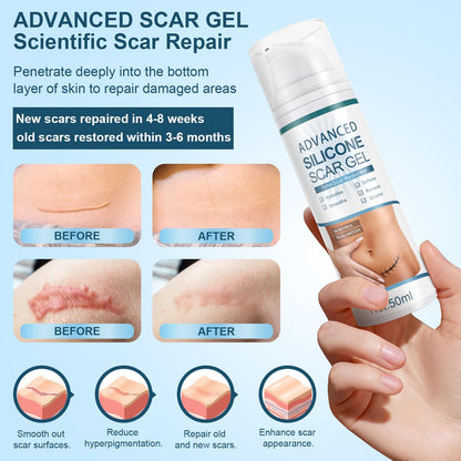 Advanced Scar Gel, Silicone Scar Gel, Treats Old and New Scars, Reduces the Appearance of Scars from, Body, Face, Stretch Marks, Surgical Scar, Keloids, Acne, Burns and More, 50g (1.7 Oz)