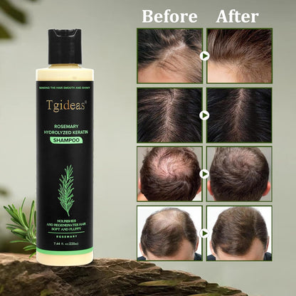 Rosemary & Biotin Shampoo for Thinning Hair, Volumizing Shampoo for Fuller, Thicker Hair, Strengthening & Nourishing Formula with Root Lift, Gentle Daily Care for Women & Men (7.4 fl oz)