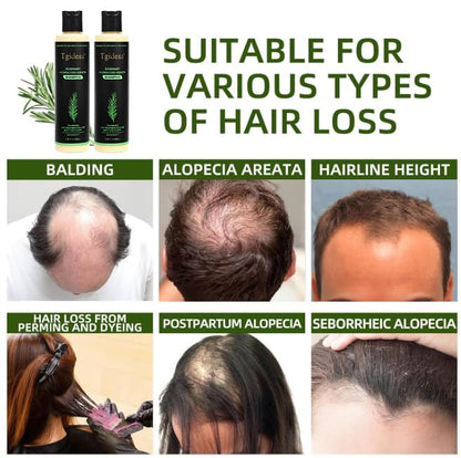 Rosemary & Biotin Shampoo for Thinning Hair, Volumizing Shampoo for Fuller, Thicker Hair, Strengthening & Nourishing Formula with Root Lift, Gentle Daily Care for Women & Men (7.4 fl oz)