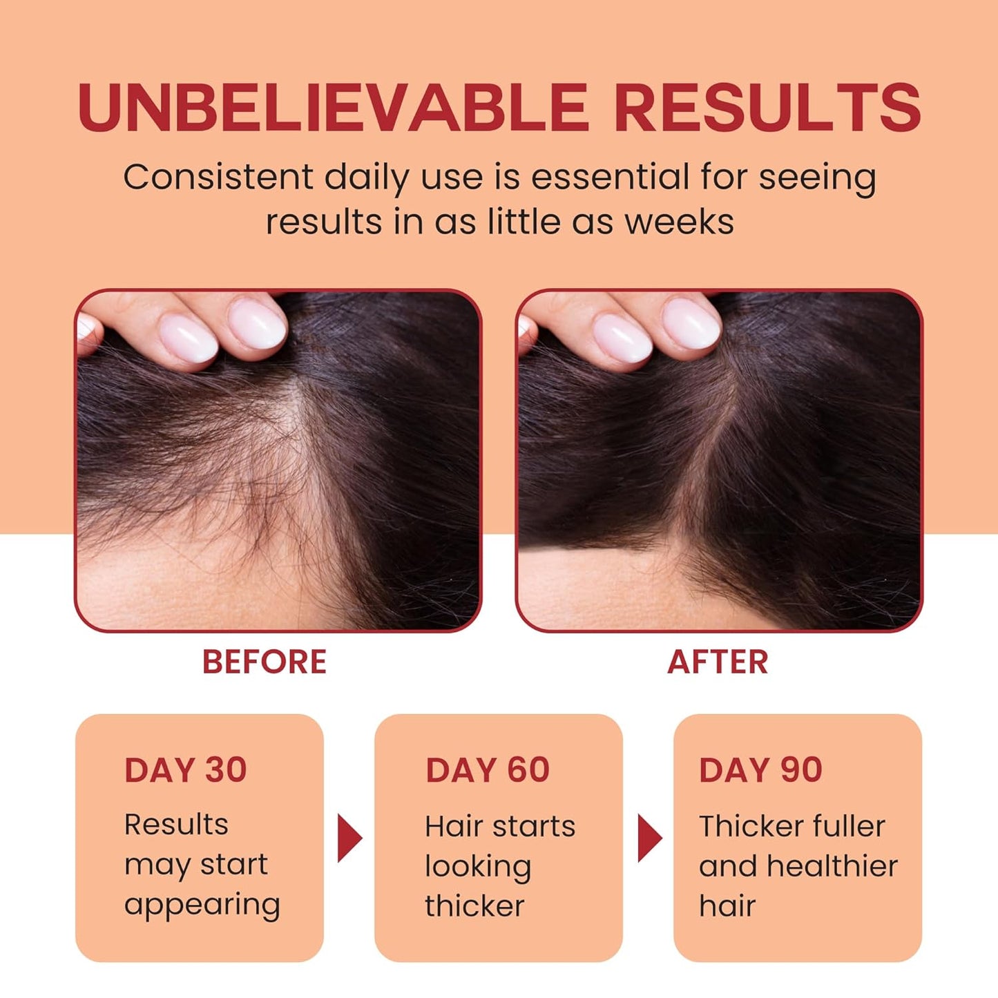 Lebanta Raw Batana Oil for Hair Growth - 100% Pure, Organic 4oz Batana from Honduras for Thick and Strong Natural Hair - Dr. Sebi Unrefined Cold Pressed Cosmetic Scalp Mask Gifts for Women (1 Pack)