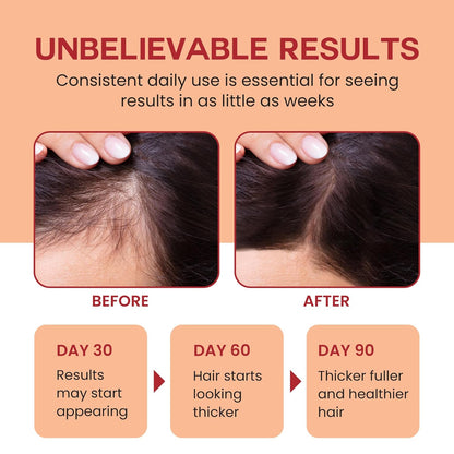 Lebanta Raw Batana Oil for Hair Growth - 100% Pure, Organic 4oz Batana from Honduras for Thick and Strong Natural Hair - Dr. Sebi Unrefined Cold Pressed Cosmetic Scalp Mask Gifts for Women (1 Pack)